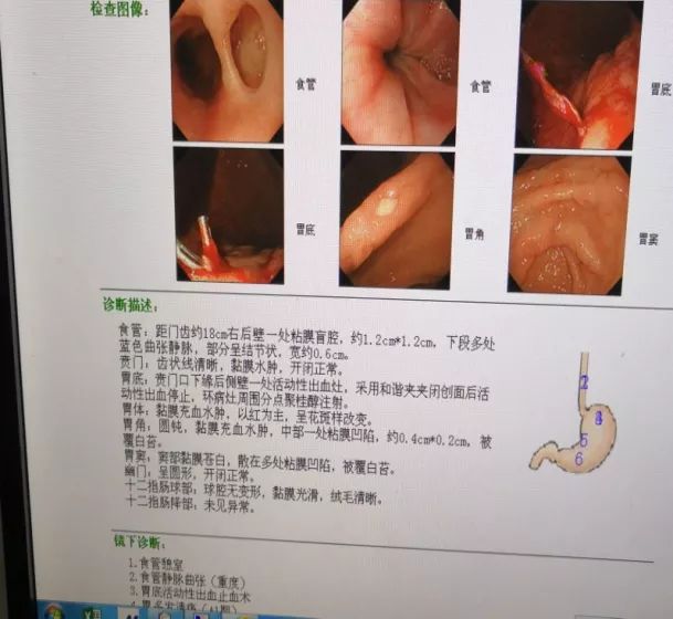 溴門王中王一港澳王中王,指甲出現(xiàn)黑線是癌癥預(yù)警？科普